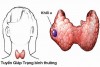 CHẾ ĐỘ DINH DƯỠNG CHO BỆNH NHÂN SAU PHẪU THUẬT UNG THƯ TUYẾN GIÁP