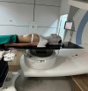 BIẾN CHỨNG GIẢM THÍNH LỰC Ở BỆNH NHÂN UNG THƯ VÒM HỌNG SAU XẠ TRỊ: ĐIỀU BẠN CẦN BIẾT