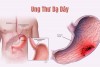 NGUYÊN NHÂN BỆNH UNG THƯ DẠ DÀY